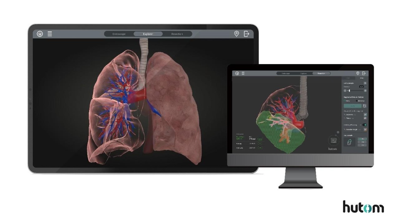 휴톰, ‘MEDICA 2025’ 참가