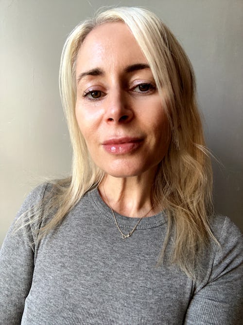 나는 Evolysse 립 필러를 얻었고 나의 미묘하고 자연스러운 결과를 좋아합니다